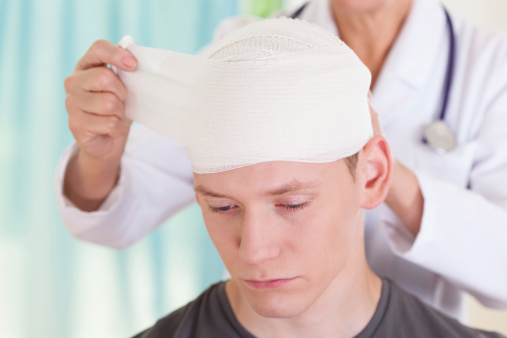 3 Reasons You Need an Attorney for a Brain Injury Claim