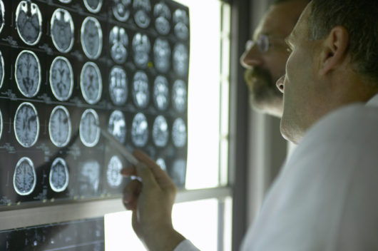 Do You Need an MRI or an X-Ray After Your Auto Accident in California? 