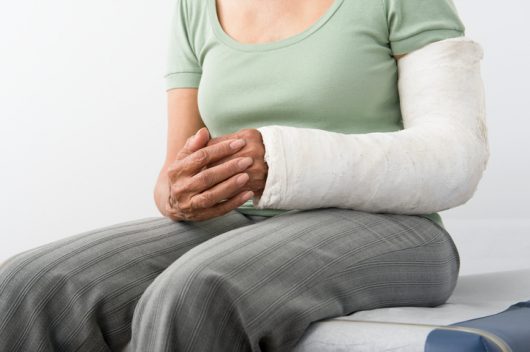 Are You Getting Proper Treatment for Your Broken Bone?