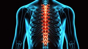 Truck Accidents Can Lead to Serious Spinal Cord Injuries