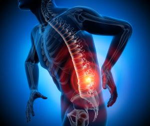 Learn How Lower Back Injuries Occur and Why They Are So Common in Car Accidents