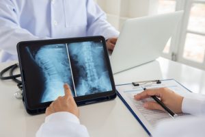 The Right Personal Injury Attorney Can Help You Get Help for Your Spinal Cord Injury