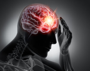 Discover the Three Most Common Causes of Traumatic Brain Injuries