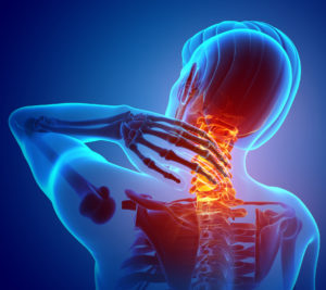 Car Accidents Can Cause Serious Neck Injuries – Learn How an Attorney Can Help You Recover Compensation for Your Injuries